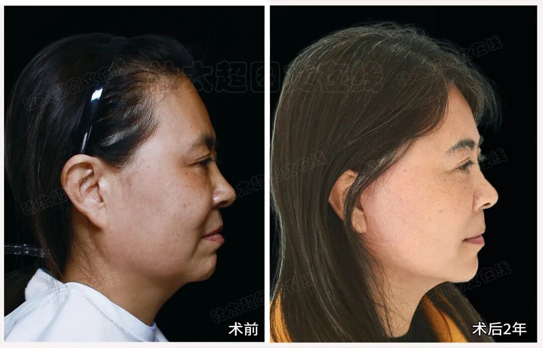 1776247126106966.jpg 微信图片_2026-04-15_175458_445.jpg