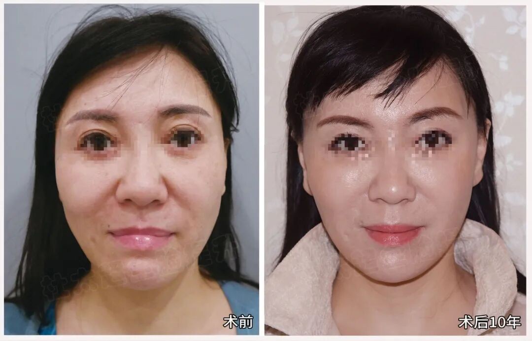 1781865518186588.jpg 微信图片_2026-06-19_183416_728.jpg