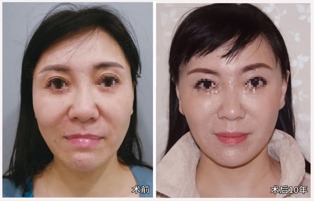 1781865573771071.jpg 微信图片_2026-06-19_183430_464.jpg