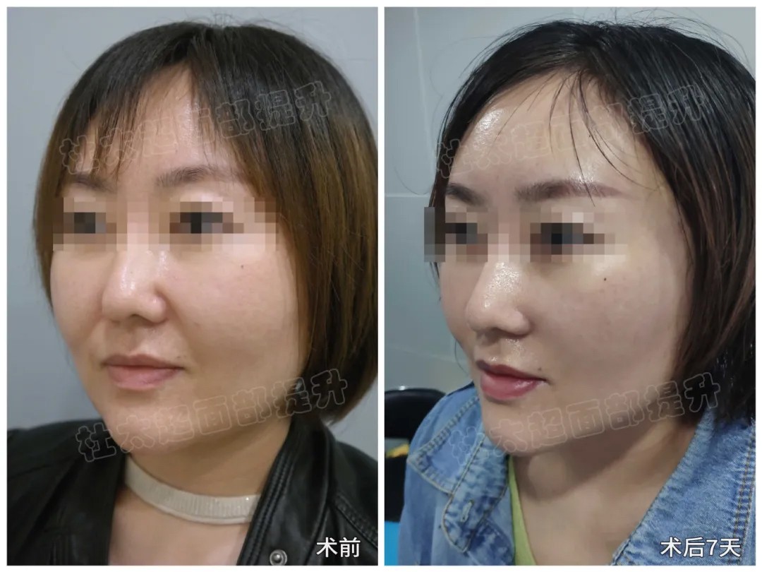 1782903096232211.jpg 微信图片_2026-07-01_184729_661.jpg