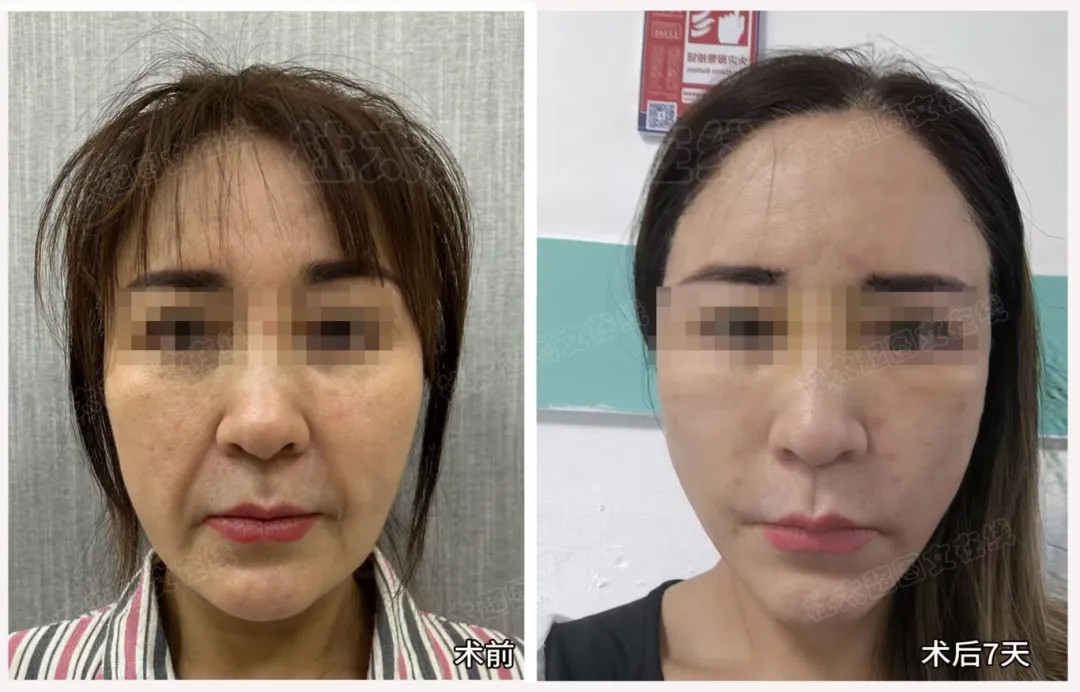 1785923335206579.jpg 微信图片_2026-08-05_174309_286.jpg
