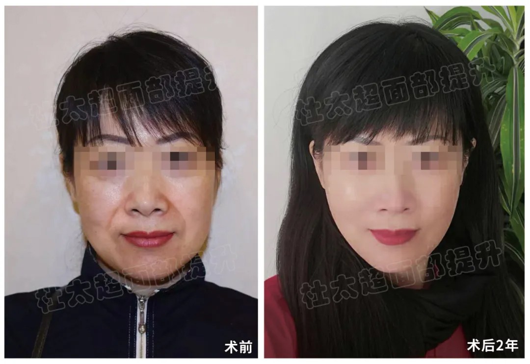1786365992188003.jpg 微信图片_2026-08-10_204505_915.jpg
