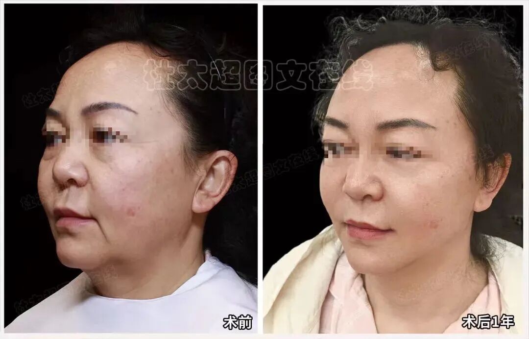 1786446889907014.jpg 微信图片_2026-08-11_191302_449.jpg
