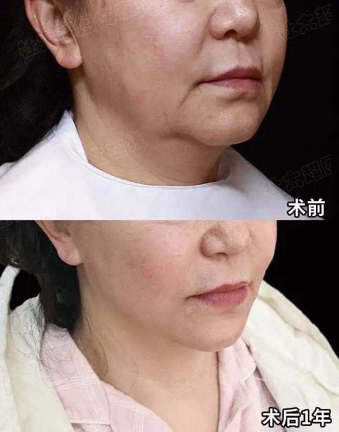 1786446875635272.jpg 微信图片_2026-08-11_191300_045.jpg