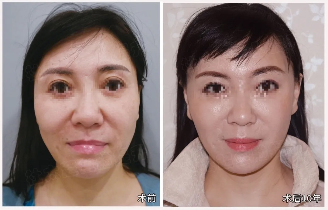 1786790447110604.jpg 微信图片_2026-08-15_183921_817.jpg