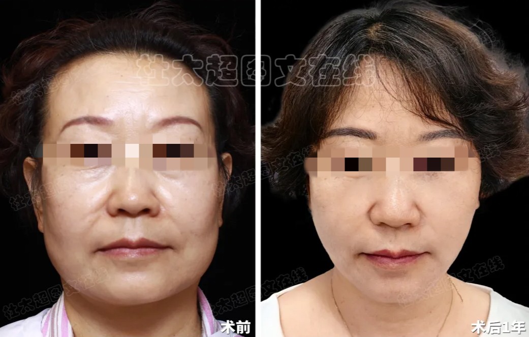 1786969425183542.jpg 微信图片_2026-08-17_202230_346.jpg
