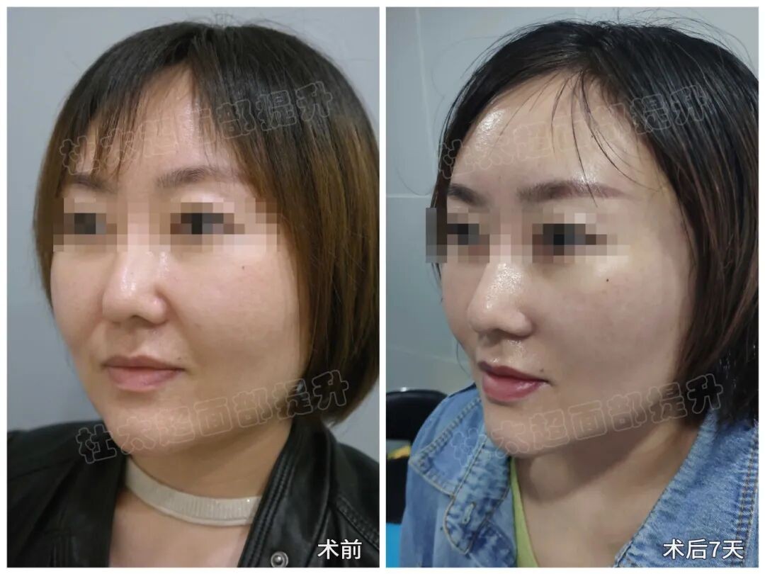 1787397842570701.jpg 微信图片_2026-08-22_192320_266.jpg
